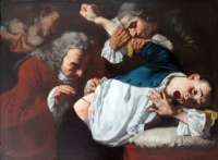 Traversi, 1753: " Die Operation". ©  Ausstellungskatalog, Staatsgalerie Stuttgart 2003. Hatje Cantz Verlag / wikipedia